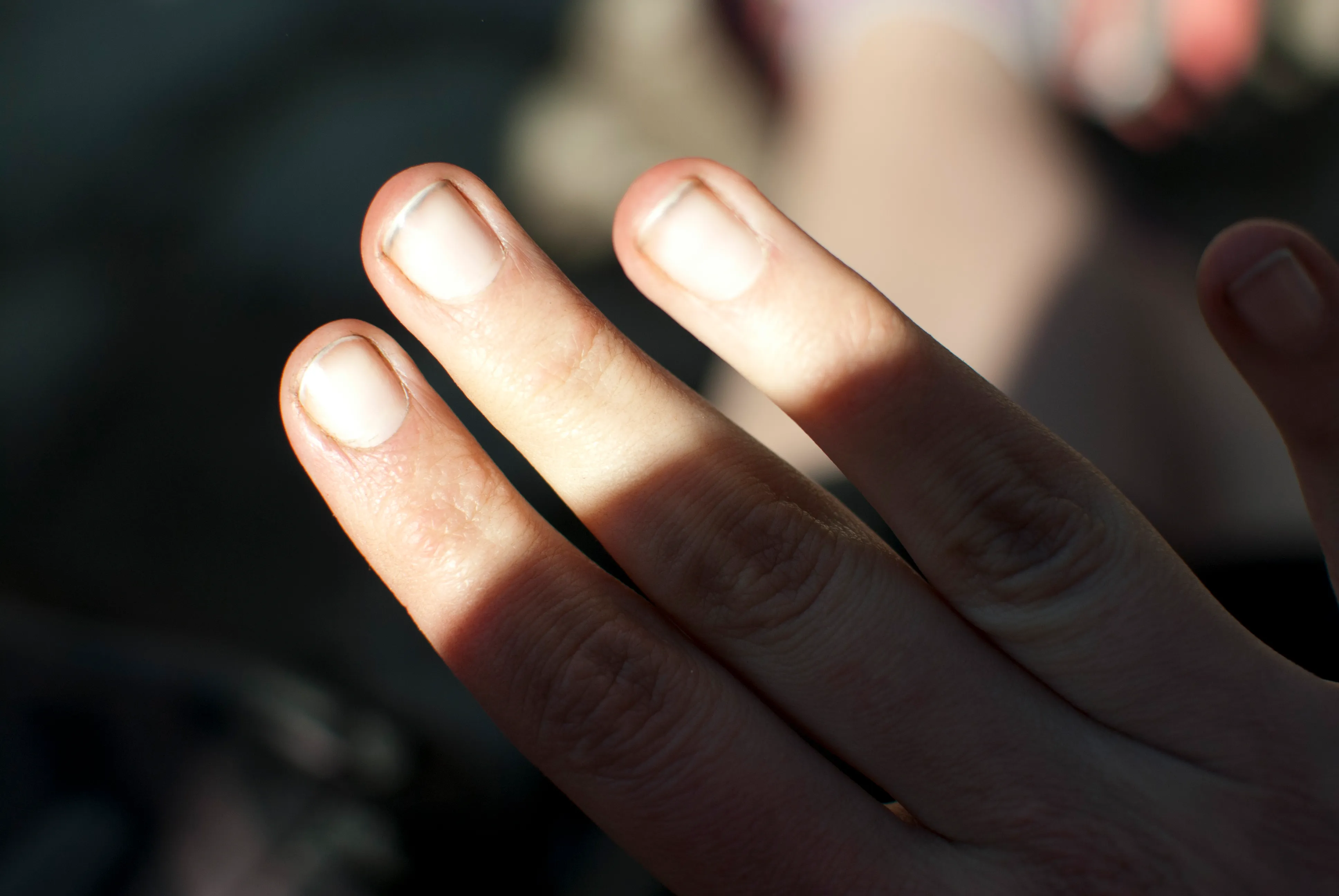Dirty nails